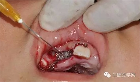 31.webp.jpg 31.webp.jpg