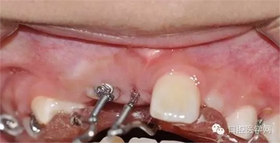 38.webp.jpg 38.webp.jpg