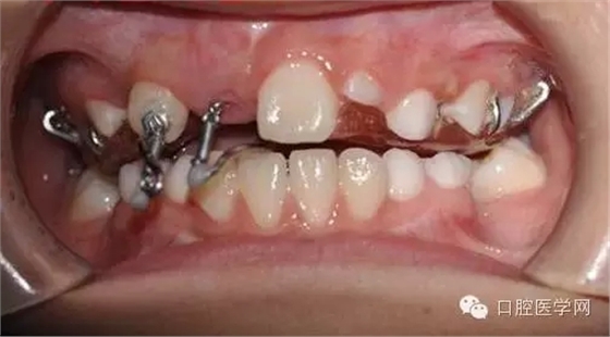 39.webp.jpg 39.webp.jpg