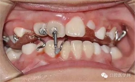 40.webp.jpg 40.webp.jpg