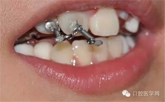 41.webp.jpg 41.webp.jpg