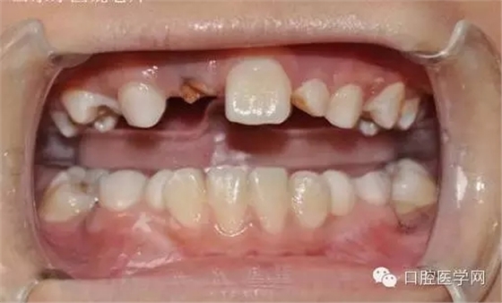 20.webp.jpg 20.webp.jpg