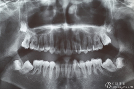 1_副本.jpg 1_副本.jpg