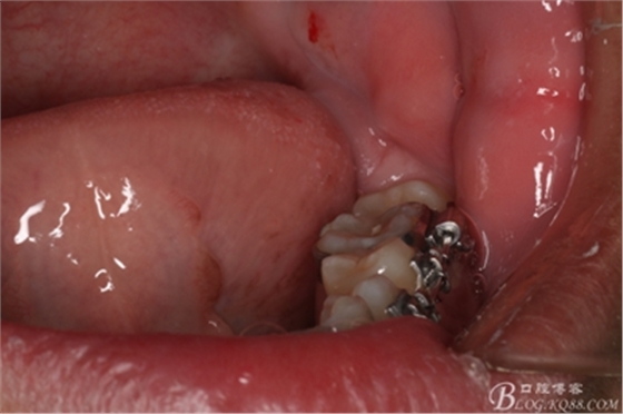 3_副本.jpg 3_副本.jpg