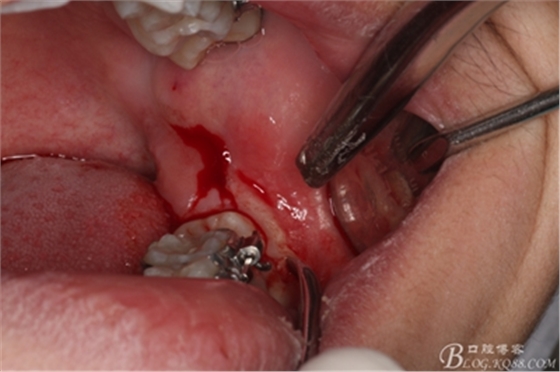 6_副本.jpg 6_副本.jpg