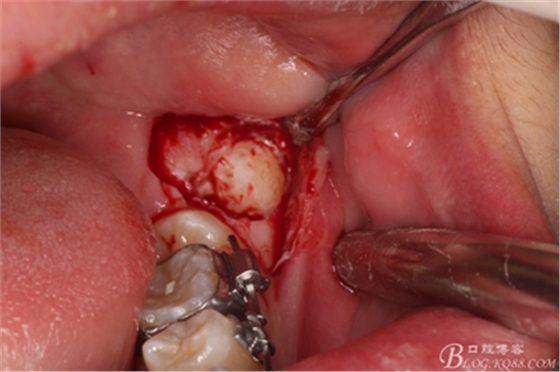 10_副本.jpg 10_副本.jpg