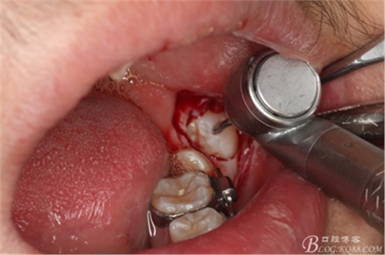 11_副本.jpg 11_副本.jpg