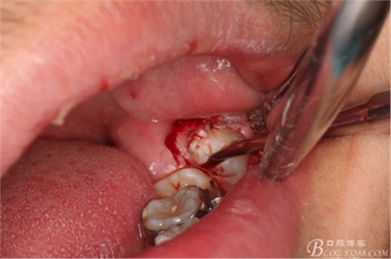 13_副本.jpg 13_副本.jpg