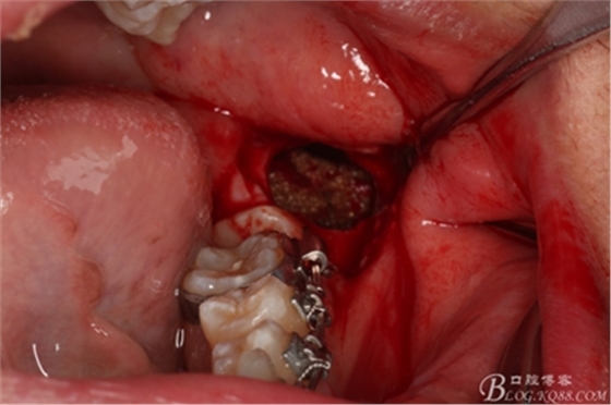 17_副本.jpg 17_副本.jpg