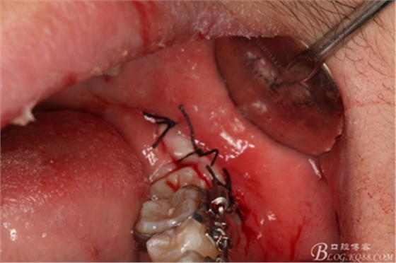 18_副本.jpg 18_副本.jpg