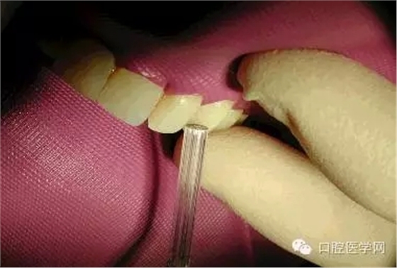 15.webp.jpg 15.webp.jpg