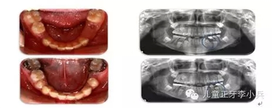 40.webp.jpg 40.webp.jpg