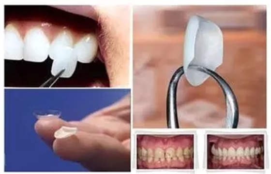 2.webp.jpg 2.webp.jpg