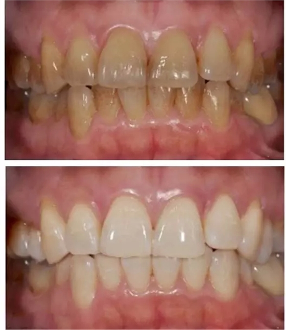 3.webp.jpg 3.webp.jpg