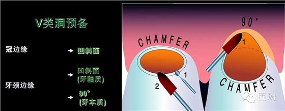 6.webp.jpg 6.webp.jpg