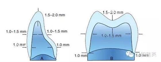 為什么牙醫(yī)叫您做二氧化鋯 看完您就知道了 為什么牙醫(yī)叫您做二氧化鋯 看完您就知道了