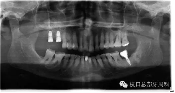 110.webp.jpg 110.webp.jpg