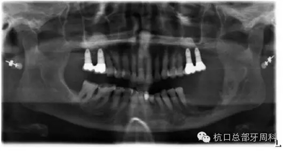 112.webp.jpg 112.webp.jpg