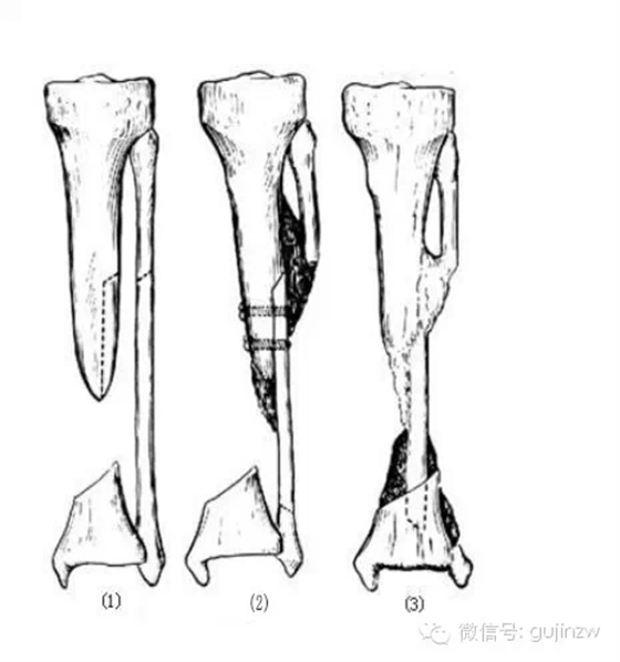 3.webp.jpg 3.webp.jpg