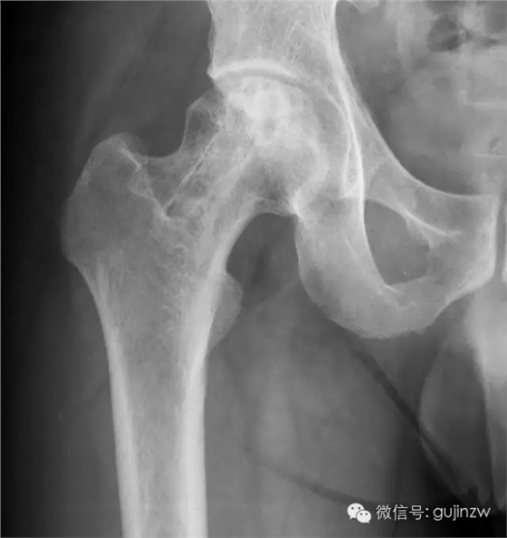 4.webp.jpg 4.webp.jpg