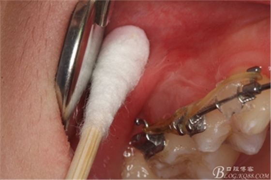 5_副本.jpg 5_副本.jpg