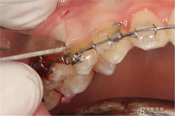 10_副本.jpg 10_副本.jpg