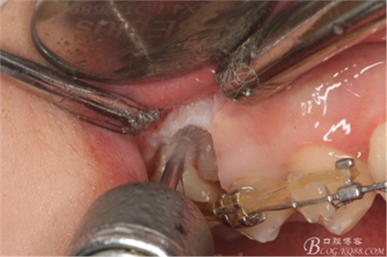 12_副本.jpg 12_副本.jpg