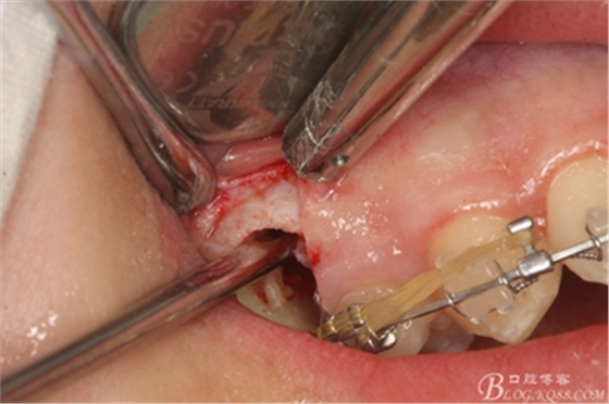 14_副本.jpg 14_副本.jpg