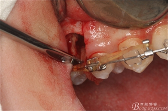 15_副本.jpg 15_副本.jpg