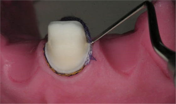 640 (4).png 640 (4).png