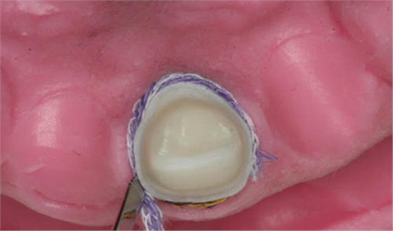 640 (5).png 640 (5).png