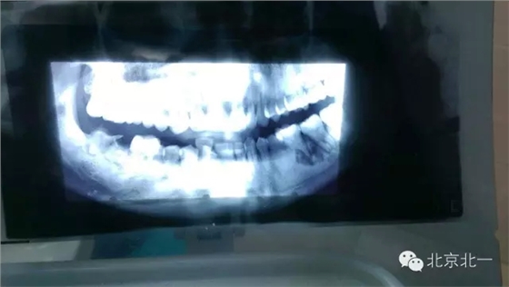 640.webp.jpg 640.webp.jpg