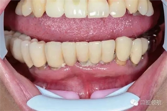 1.webp.jpg 1.webp.jpg