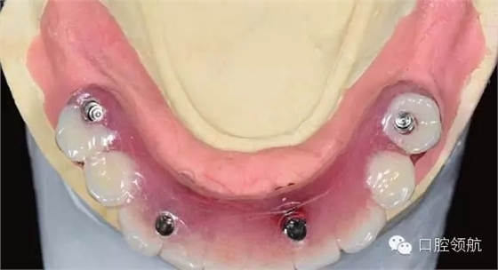 8.webp.jpg 8.webp.jpg