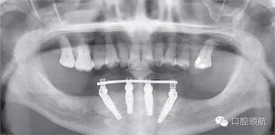 10.webp.jpg 10.webp.jpg