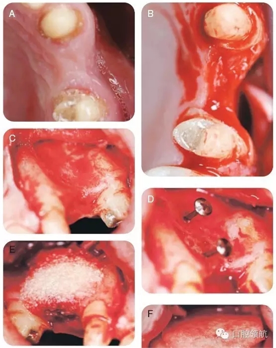 7.webp.jpg 7.webp.jpg