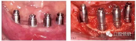 640.webp (3).jpg 640.webp (3).jpg