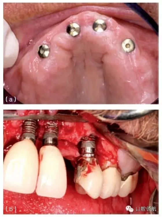 640.webp (4).jpg 640.webp (4).jpg