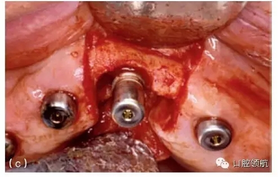 640.webp (5).jpg 640.webp (5).jpg