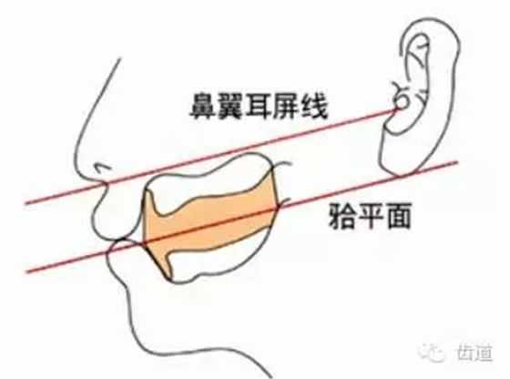 1.webp.jpg 1.webp.jpg