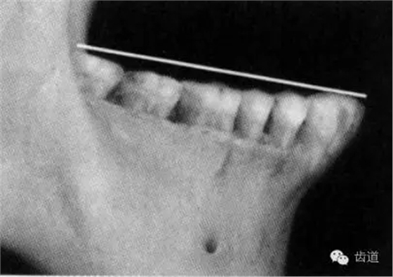 2.webp.jpg 2.webp.jpg