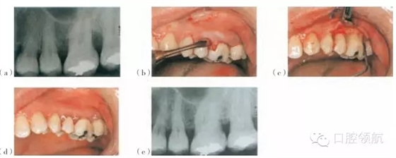 5.webp.jpg 5.webp.jpg