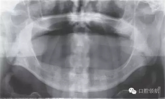 2.webp.jpg 2.webp.jpg