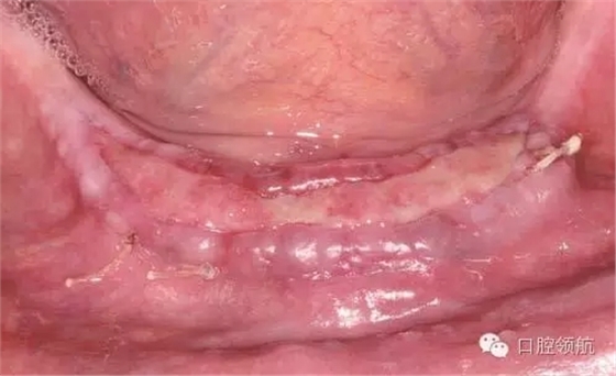 7.webp.jpg 7.webp.jpg