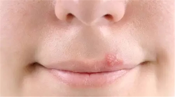 這十種常見口腔疾病，你有遇到過么？