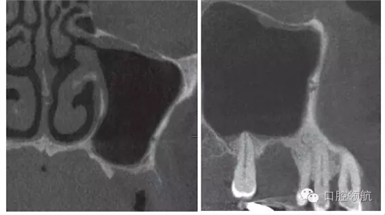 4.webp.jpg 4.webp.jpg