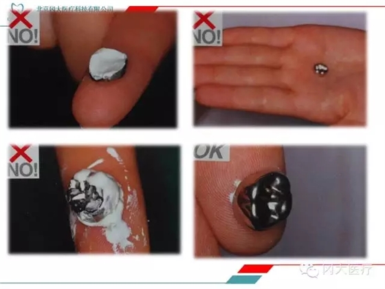 預成冠（PMC） 作者：玄松玉