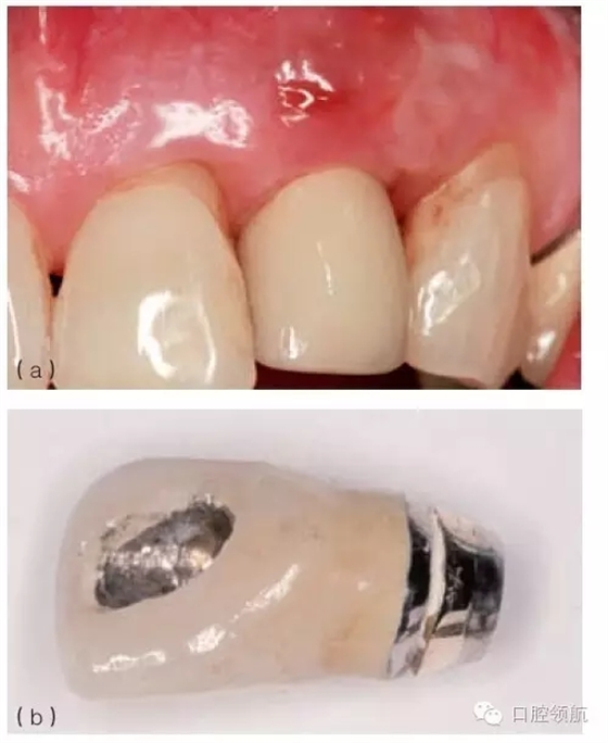 2.webp.jpg 2.webp.jpg