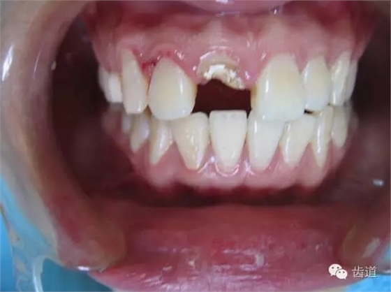 5.webp.jpg 5.webp.jpg