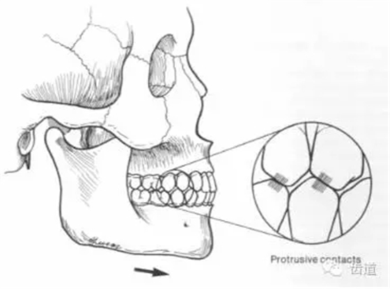 11.webp.jpg 11.webp.jpg